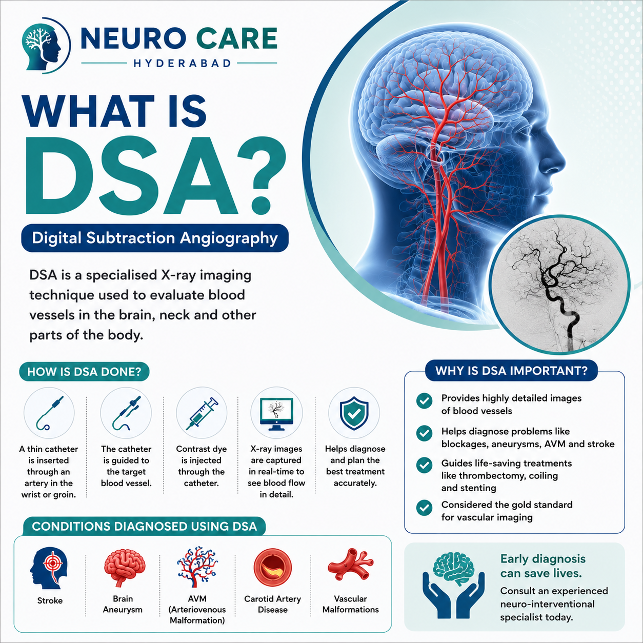 What is DSA?