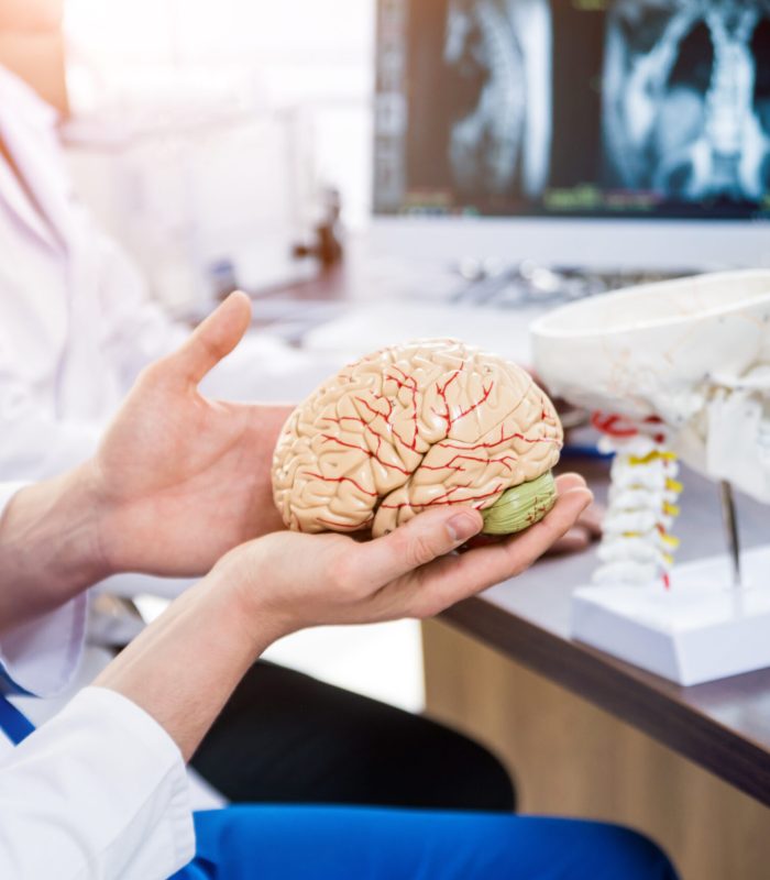 Two doctors having medical council in hospital. Discussing medical issues before brain surgery. Brain layout